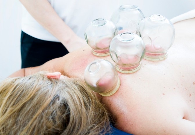 11. Cupping Therapy Cost2