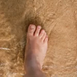 Is It Bad to Crack Your Bunion - How To Treat Bunions